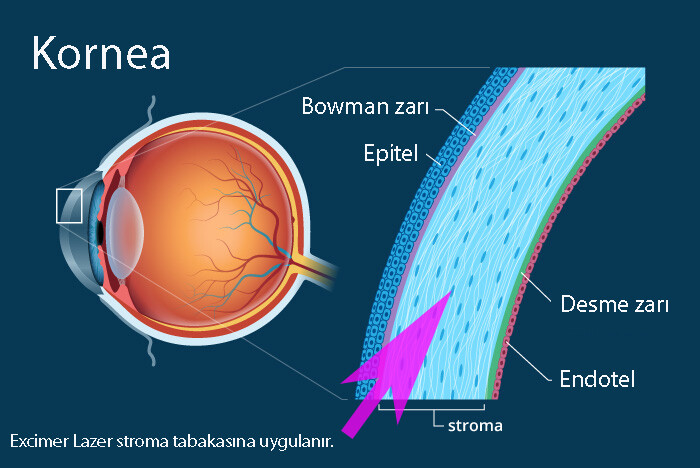 Kornea Anatomisi ve ince kornea